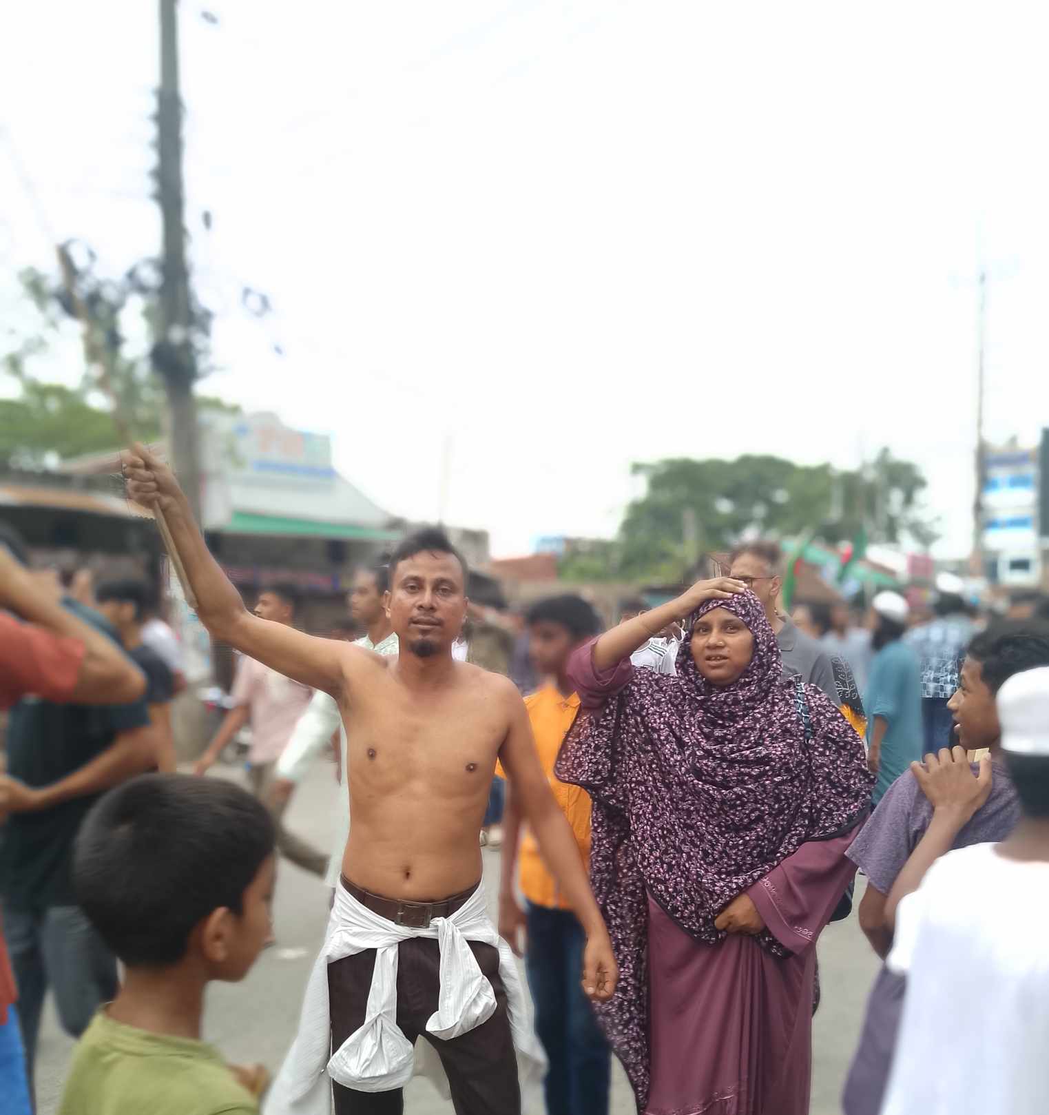 বৈষম্য বিরোধী ছাত্র আন্দোলনে রাবার বুলেট ও টিয়ারশেল আঘাত প্রাপ্ত হয়ে মানবেতর জীবন-যাপন করছেন মোহাম্মদ আমিনুল ইসলাম