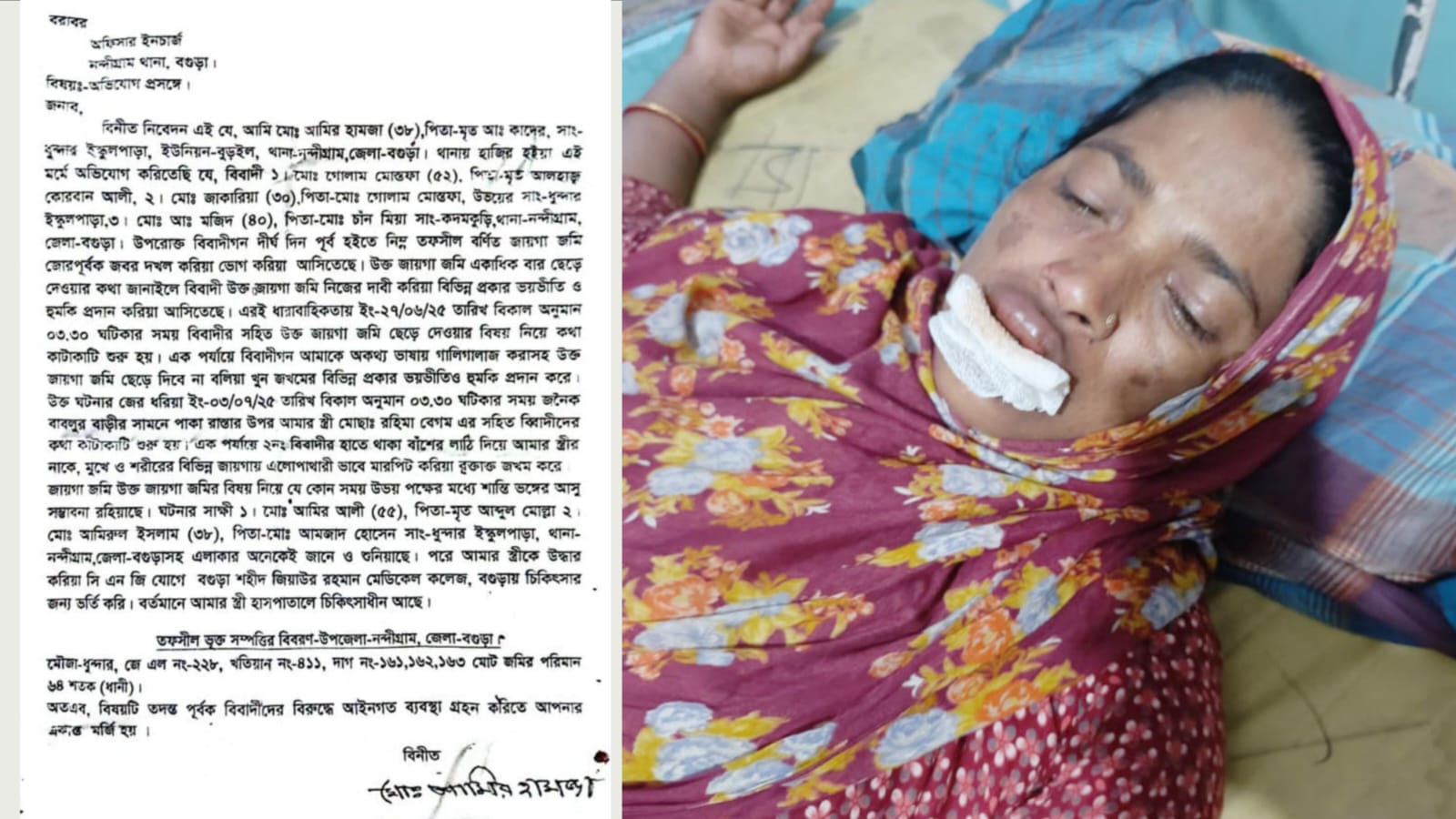 নন্দীগ্রামে জায়গা জমির জেরে প্রতিপক্ষের হামলায় নারী আহত