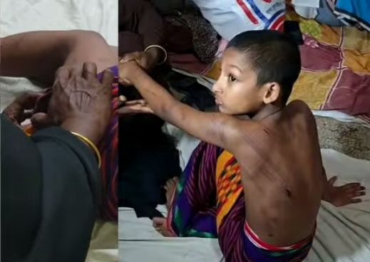 নরসিংদীতে মাদ্রাসার শিক্ষার্থী গোসল না করায় শিশুকে পৈশাচিক মারধর